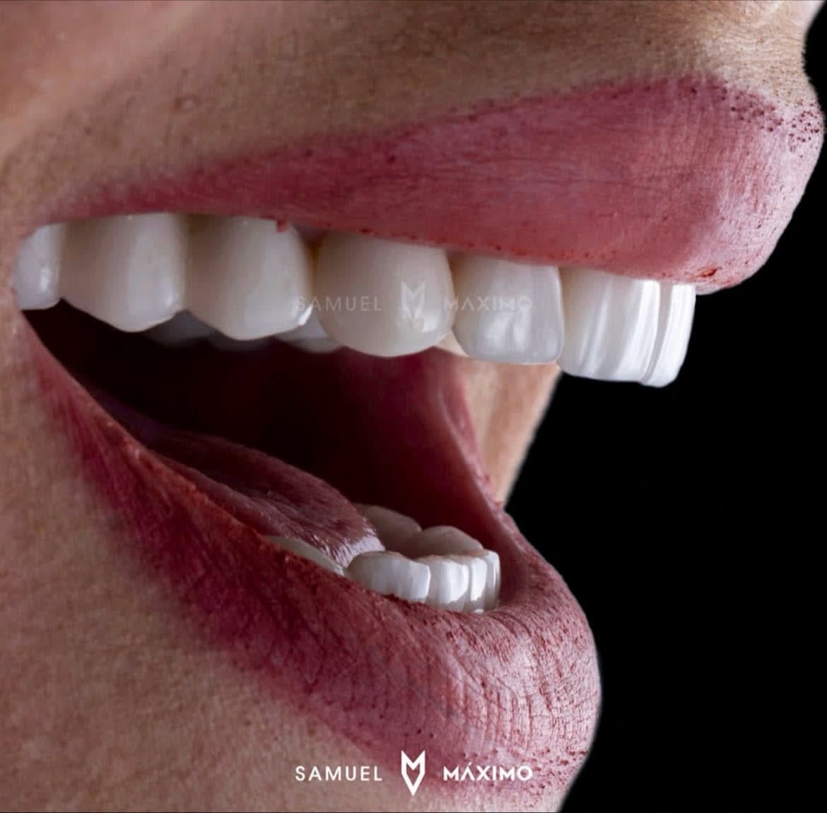 Odontología Preventiva